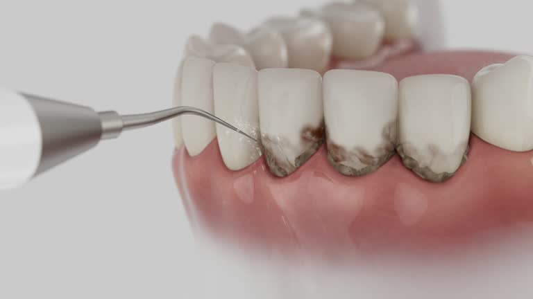 Reliable Dental Implants contractor in Lindale, TX by Smile Center Dentistry